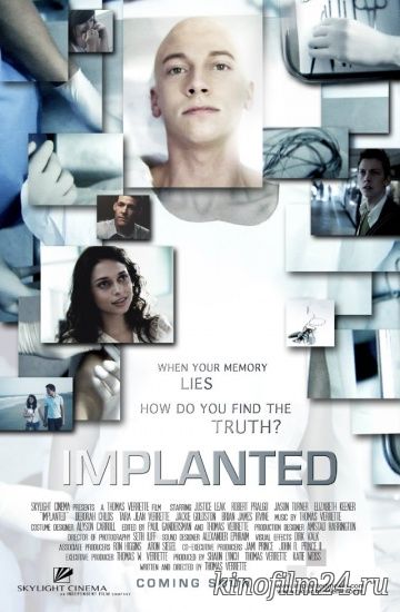 Имплант / Implanted